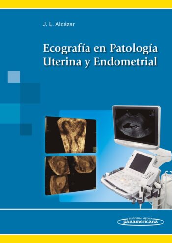 Ecografía en Patología Uterina y Endometrial