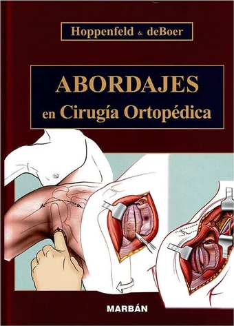 Abordajes en Cirugía Ortopédica