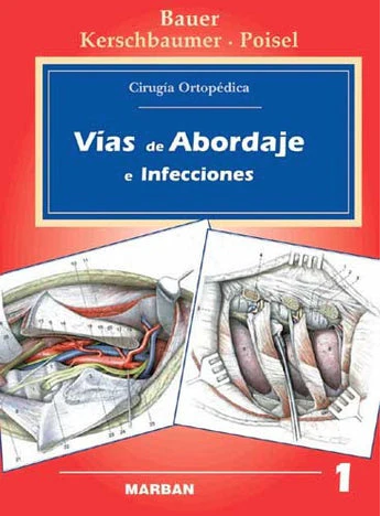 Cirugía Ortopédica - Vías de Abordaje e Infecciones. Vol 1.