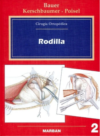 Cirugía Ortopédica - Rodilla. Vol 2