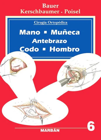 Cirugía Ortopédica - Mano, Muñeca, Antebrazo, Codo, Hombro Vol. 6