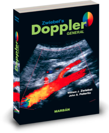 Zwiebel´s Doppler General