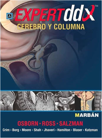 Expert DDX Cerebro y Columna - Diagnóstico Diferencial - Amirsys