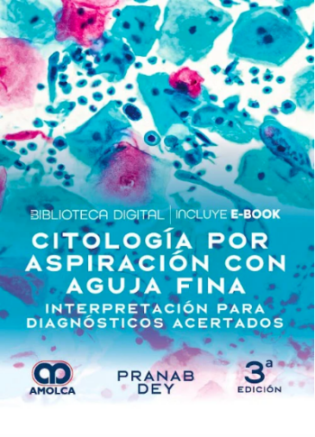 Citología por Aspiración con Aguja Fina. Interpretación para Diagnósticos Acertados
