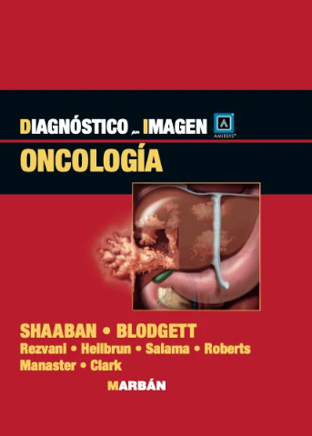 Diagnóstico por Imagen - Oncología - Amirsys