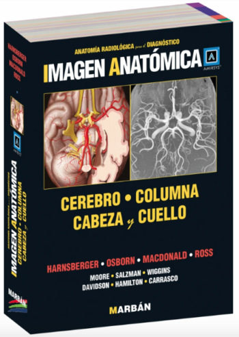 Imagen Anatómica - Cerebro, columna, cabeza y cuello - Amirsys